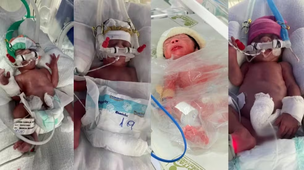 Quadrig&ecirc;meos nascem no Paran&aacute; ap&oacute;s casal tentar ter filhos por quatro anos