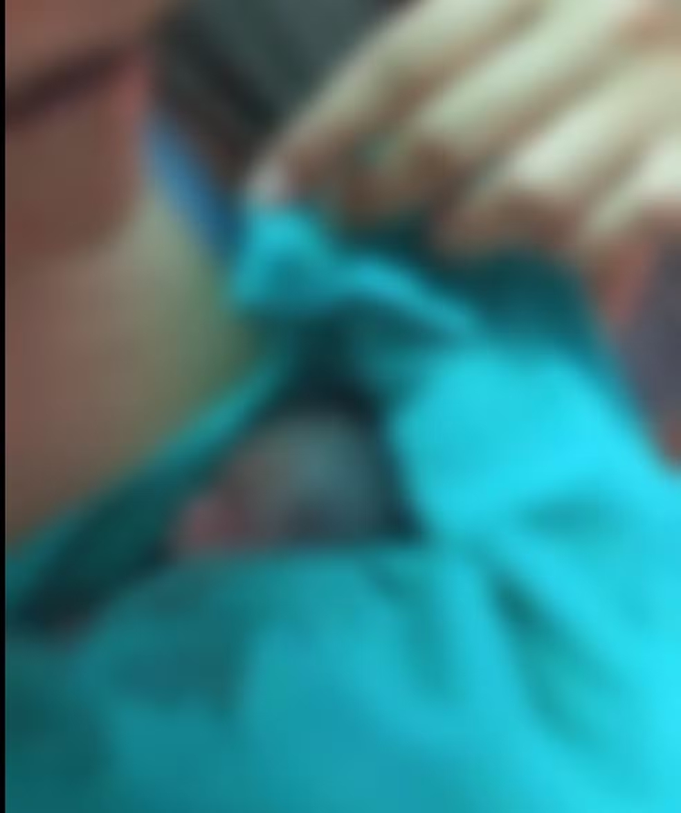 Beb&ecirc; dado como morto retirado do pr&oacute;prio vel&oacute;rio no AC respira com ajuda de aparelhos, diz Sa&uacute;de